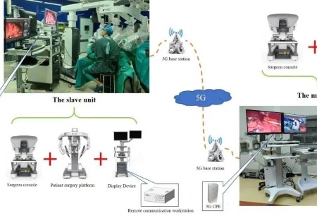 Intelligent Surgery論文推薦丨5G遠(yuǎn)程機(jī)器人手術(shù)，開創(chuàng)胃癌治療的新時(shí)代